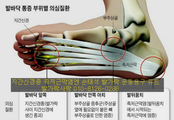 발가락 운동용구 듀트로 족저근막염 완치하세요.